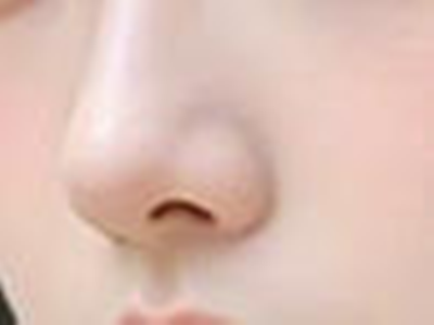 春节前想隆鼻变美？这6条信息差助你“一次上岸”