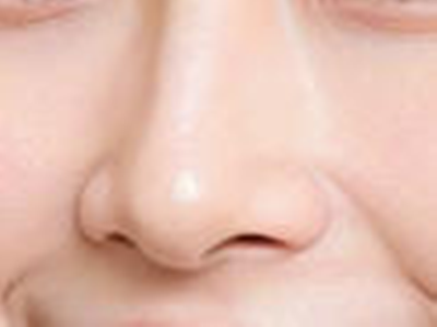 鼻孔缩小搭档隆鼻术：医美联合塑形，雕琢完美立体美鼻