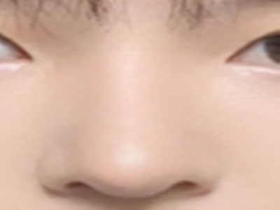 东方脸型配“妈生鼻”：避开“网红鼻”雷区的科学攻略