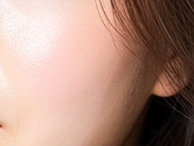 春节后“颜值告急”？这份医美急救指南助你回春