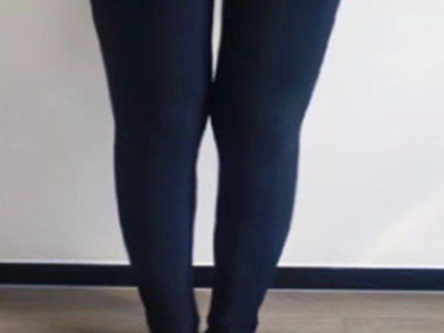 3个减肥误区比躺平更毁身！90%的人还在做