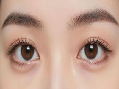 沈阳双眼皮修复多少钱？效果如何？