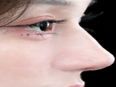 哪家整形整容医院好？如何选择靠谱的鼻整容医生？